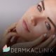Microdermabrasion à Montréal : 5 secrets d'experts pour vous